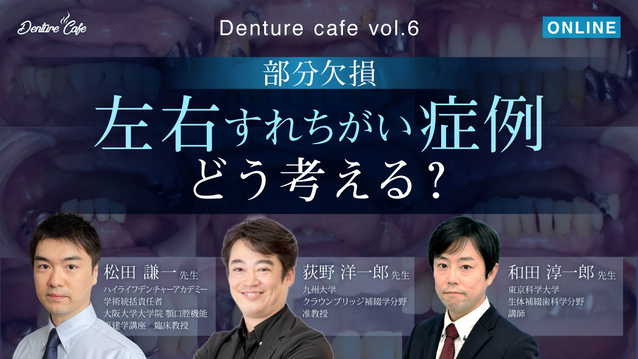 第6回「【部分欠損】左右すれちがい症例をどう考える？」のサムネイル