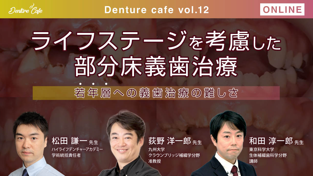 第12回「ライフステージを考慮した部分床義歯治療 Part1 」〜若年層への義歯治療の難しさ〜のサムネイル