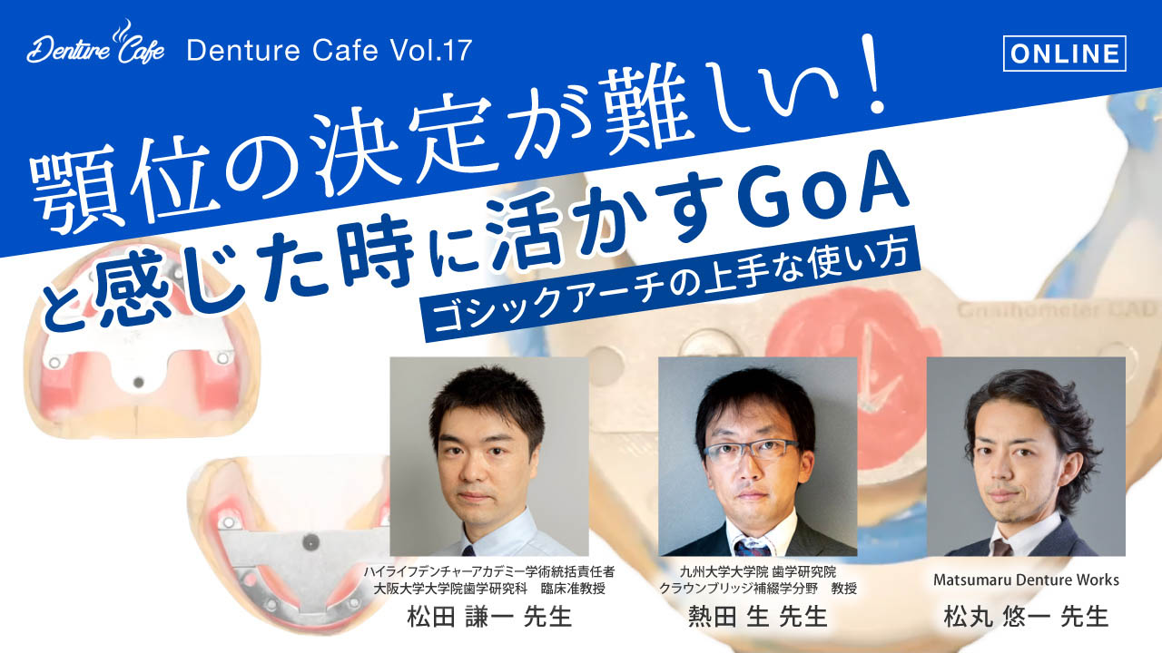 第17回「顎位の決定が難しい！と感じた時に活かすGoA」〜ゴシックアーチの上手な使い方～のサムネイル