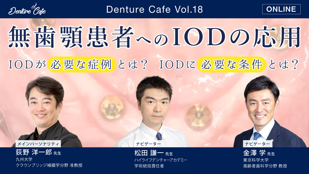 第18回「無歯顎患者へのIODの応用」〜IODが必要な症例とは？ IODに必要な条件とは？〜のサムネイル