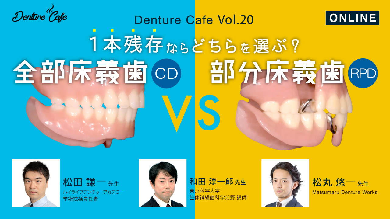 第20回「全部床義歯（CD）vs 部分床義歯（RPD）」〜1本残存ならどちらを選ぶ？～のサムネイル