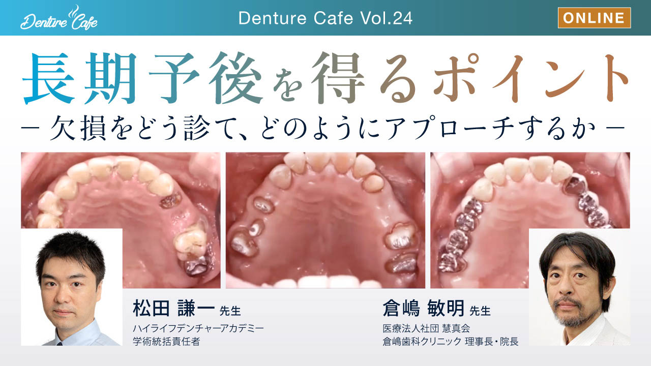 第24回「長期予後を得るポイント」 ～欠損をどう診て、どのようにアプローチするか～のサムネイル