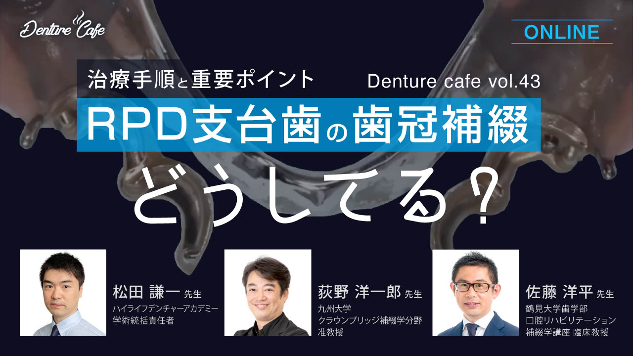 第43回「RPD支台歯の歯冠補綴、どうしてる？」〜治療手順と重要ポイント〜のサムネイル