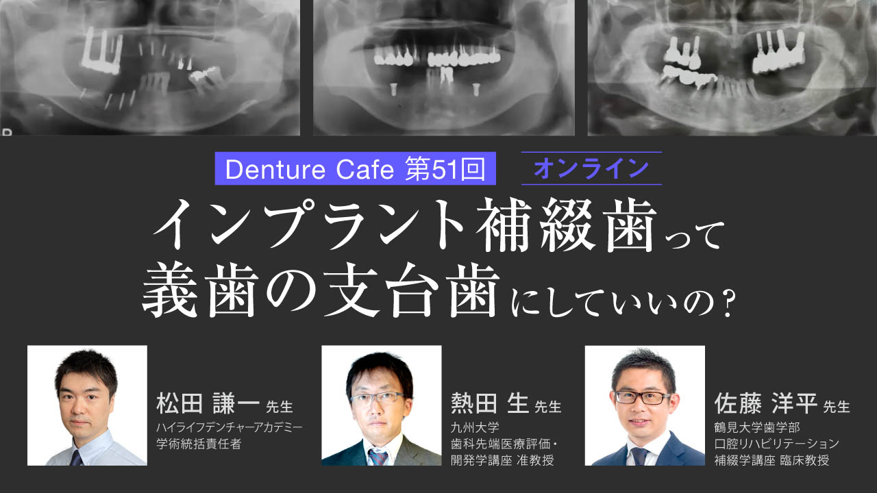 第51回「インプラント補綴歯って義歯の支台歯にしていいの？」のサムネイル