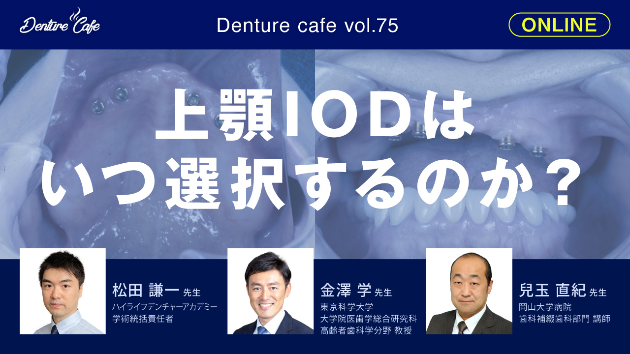 Denture Cafe 第75回 「上顎IODはいつ選択するのか？」