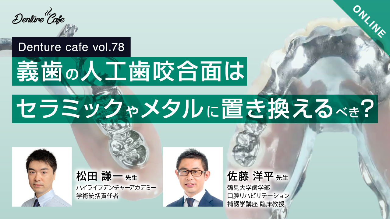 Denture Cafe 第78回 「義歯の人工歯咬合面はセラミックやメタルに置き換えるべき？」