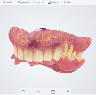 IOSを利用した義歯臨床のStep UPイメージ03