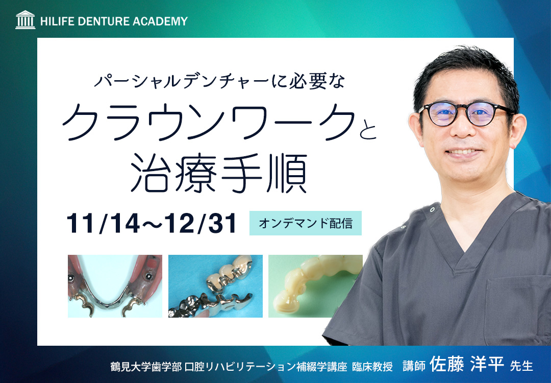 パーシャルデンチャーに必要なクラウンワークと治療手順