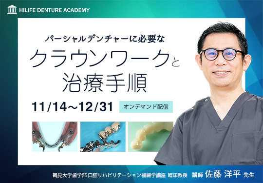 パーシャルデンチャーに必要なクラウンワークと治療手順