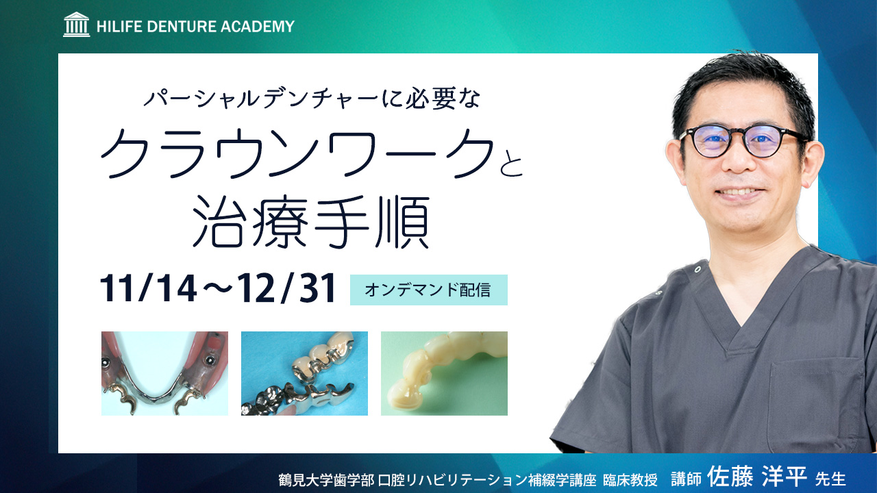 パーシャルデンチャーに必要なクラウンワークと治療手順