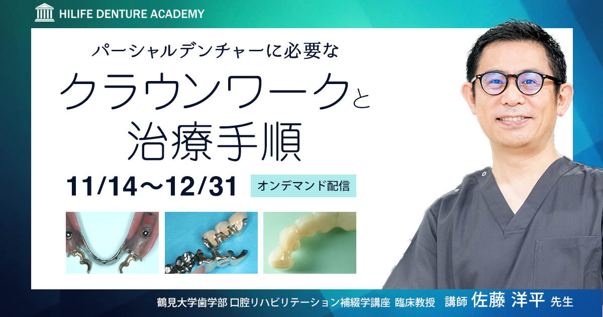パーシャルデンチャーに必要なクラウンワークと治療手順 | ハイライフ